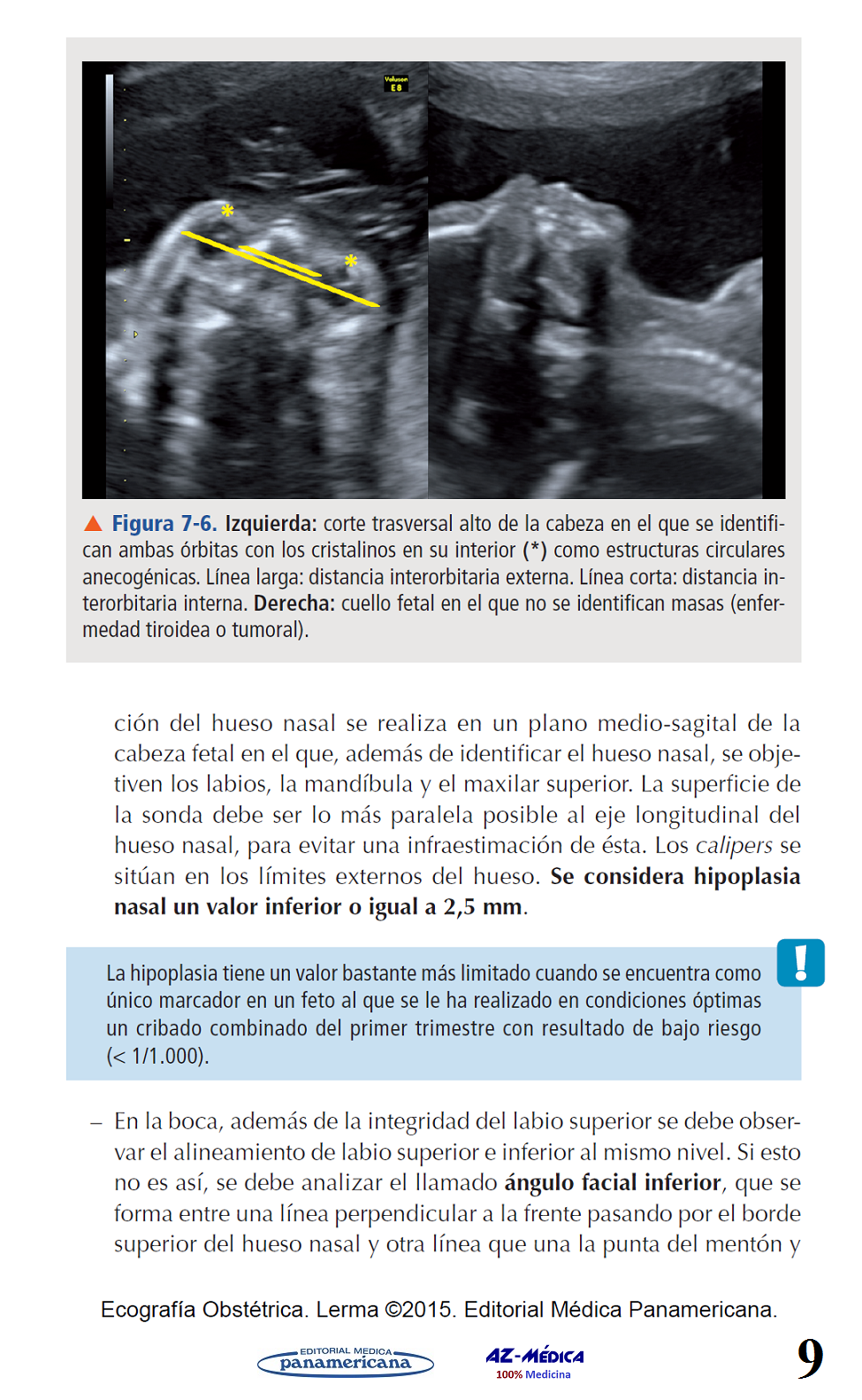 Anatomía Fetal Normal En Ecografía 1709